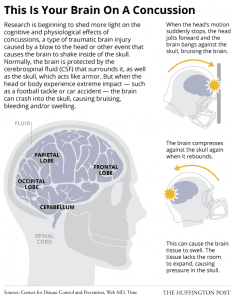 2014_Concussions